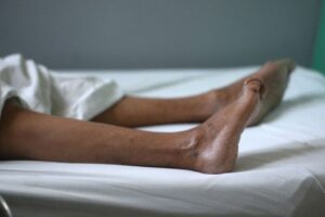 160128140806_salud_zika_guillain_barre_enfermedad_sindrome_virus_624x351_afpgetty