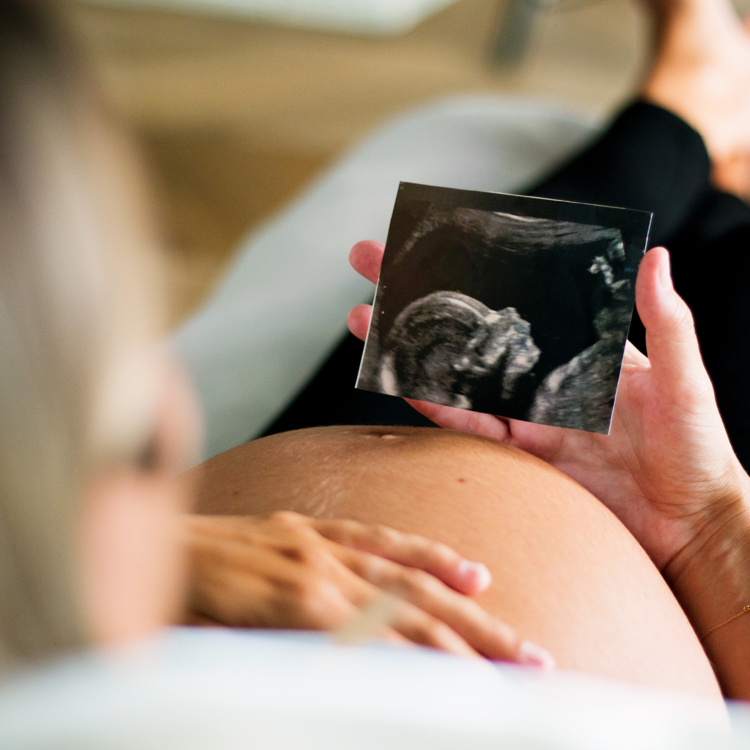 Pré-Natal de Baixo Risco é a 23ª Linha de Cuidado lançada pelo Ministério da Saúde – IATS Pré-Natal de Baixo Risco é a 23ª Linha de Cuidado lançada pelo Ministério da Saúde – IATS
